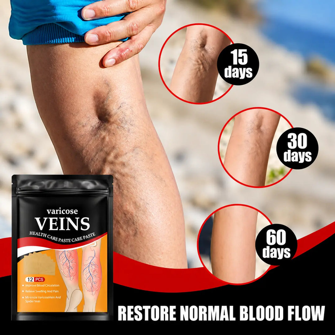 Varicose Vein Relief Patches | Natural Herbal Care for Tired, Heavy & Swollen Legs