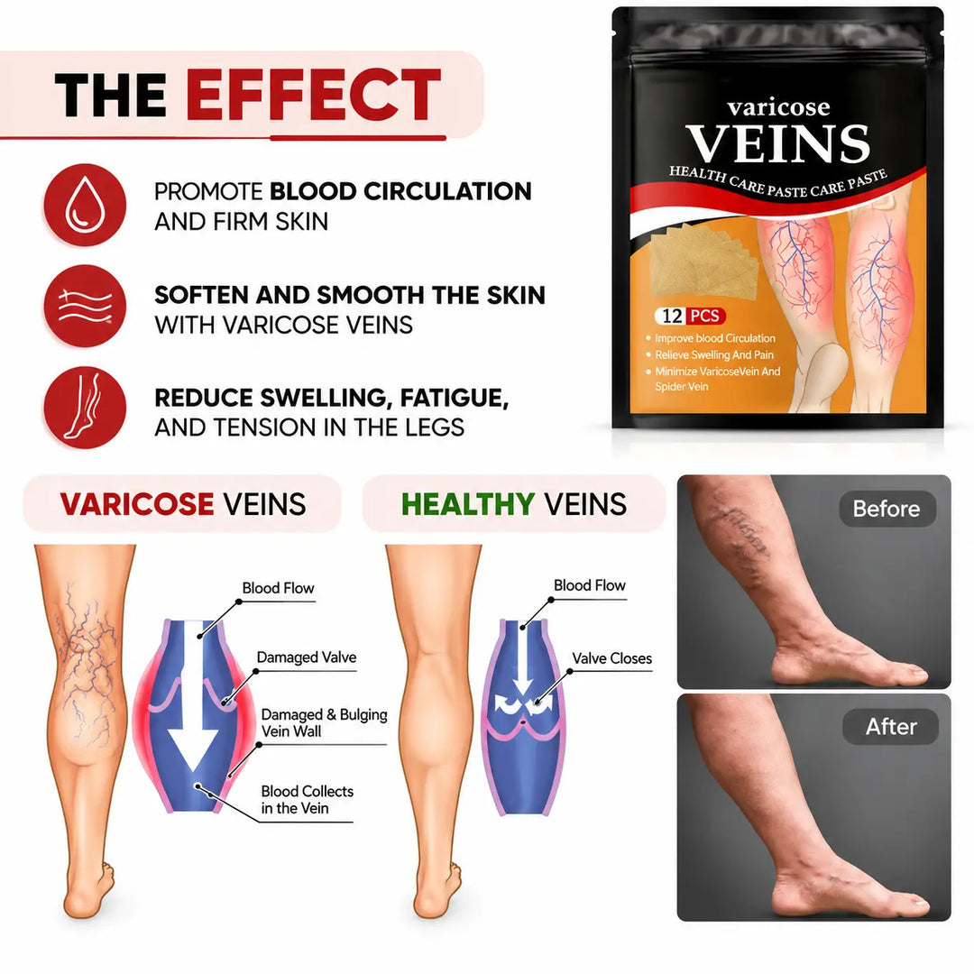 Varicose Vein Relief Patches | Natural Herbal Care for Tired, Heavy & Swollen Legs